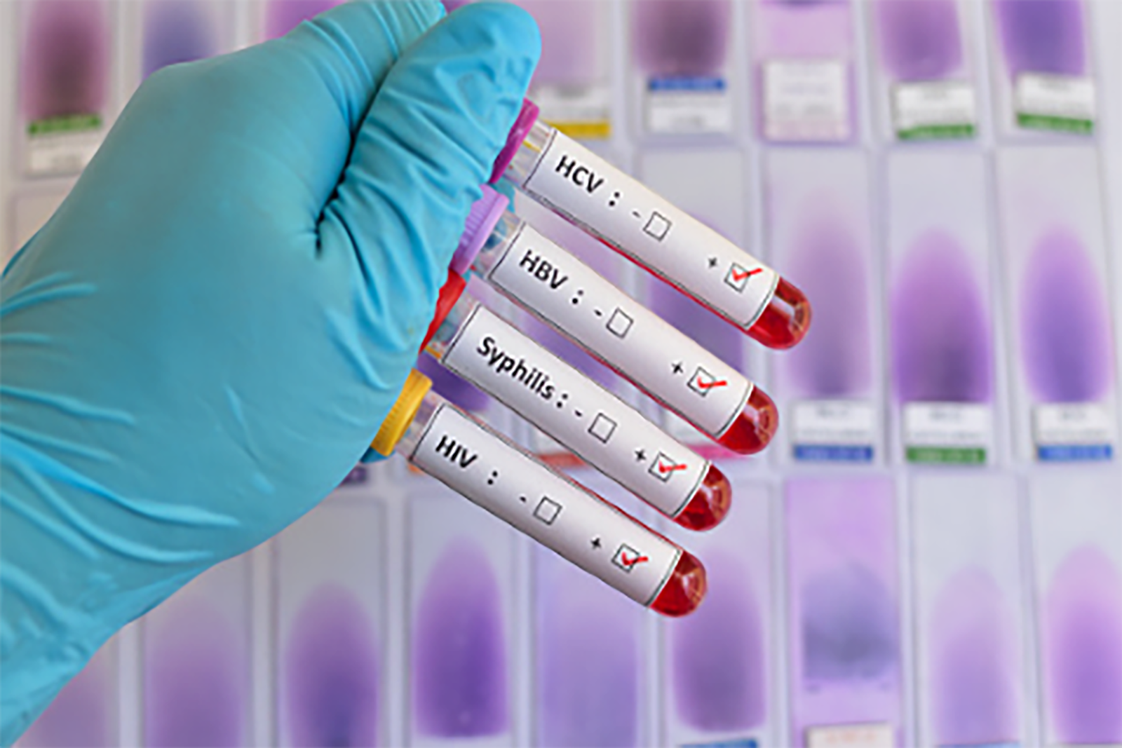 std-screenings std-screenings