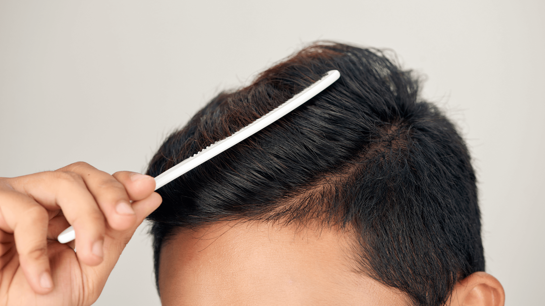 platelet-rich plasma, hair growth, regenerate hair growth