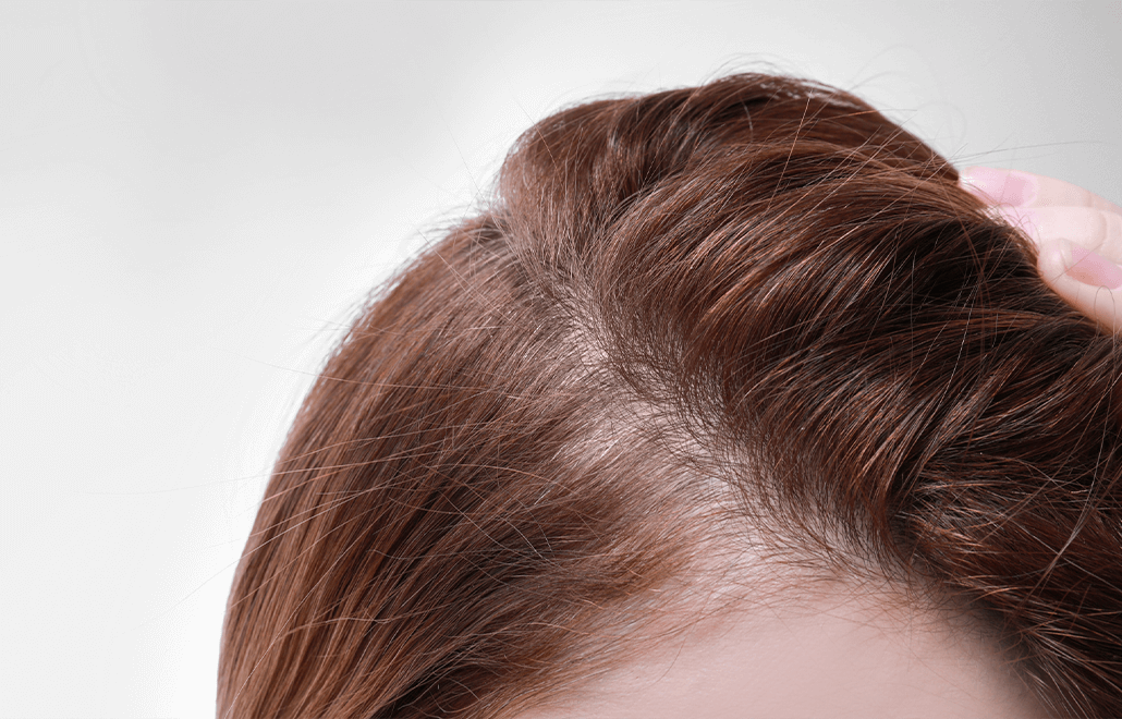 PRP, Hair Restoration, Hair Technologies